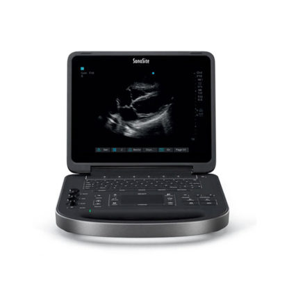 Portable Ultrasound Machine