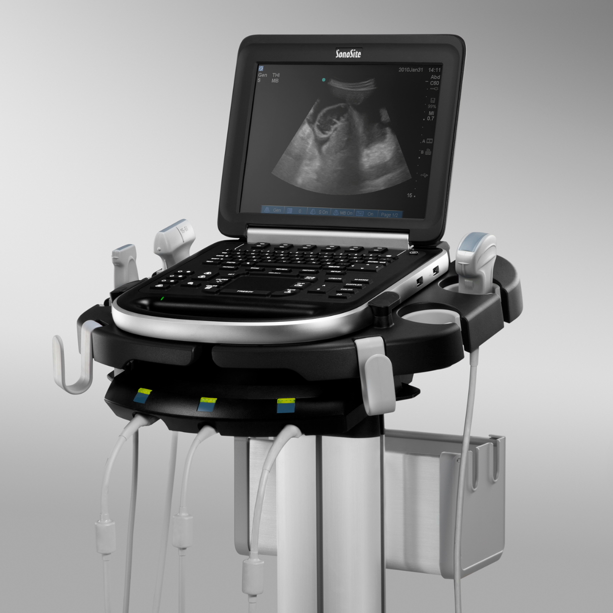 A New Portable Ultrasound for Peace Arch Hospital